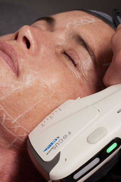 Advanced Laser & Energy-Based Rejuvenation