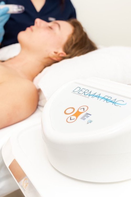 DermaFrac Infusion Therapy