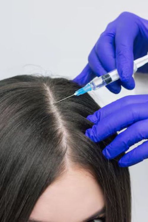 Exosome Hair Therapy