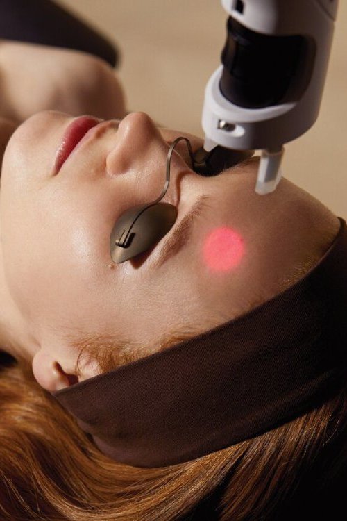 Lumière Laser Toning